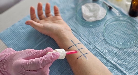 Диагностика аллергии