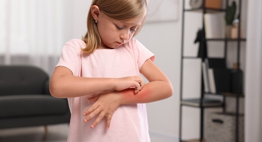 Как отличить вирусную сыпь от аллергической