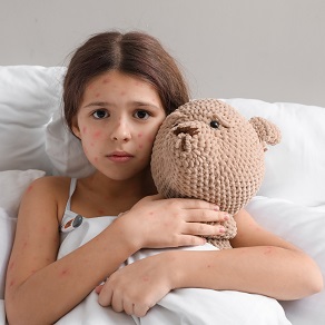 Ветрянка (ветряная оспа)