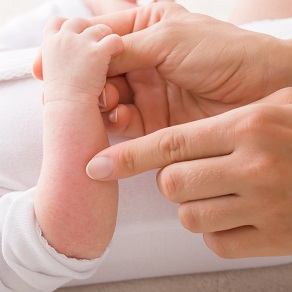 Сыпь у месячного ребенка