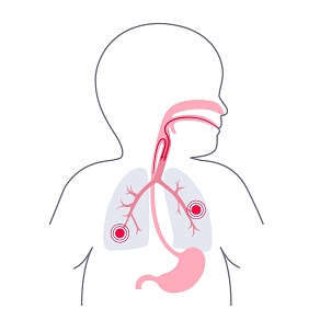 Пневмония у ребенка до 1 года