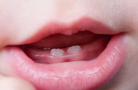 Прорезание зубов у ребенка: признаки, как понять, как помочь - НИИ Эпидемологии